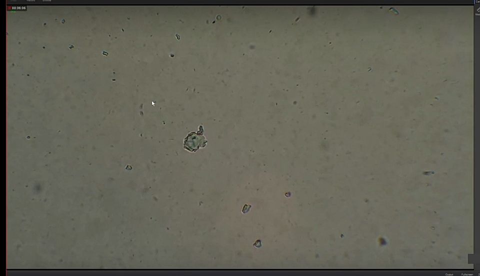 Idegen anyagok, szennyeződések az oltásban