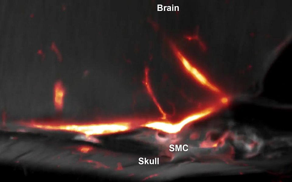 S1 fehérjék egy egér agyának prefrontális kérgében S1 fehérje intravénás beadása után