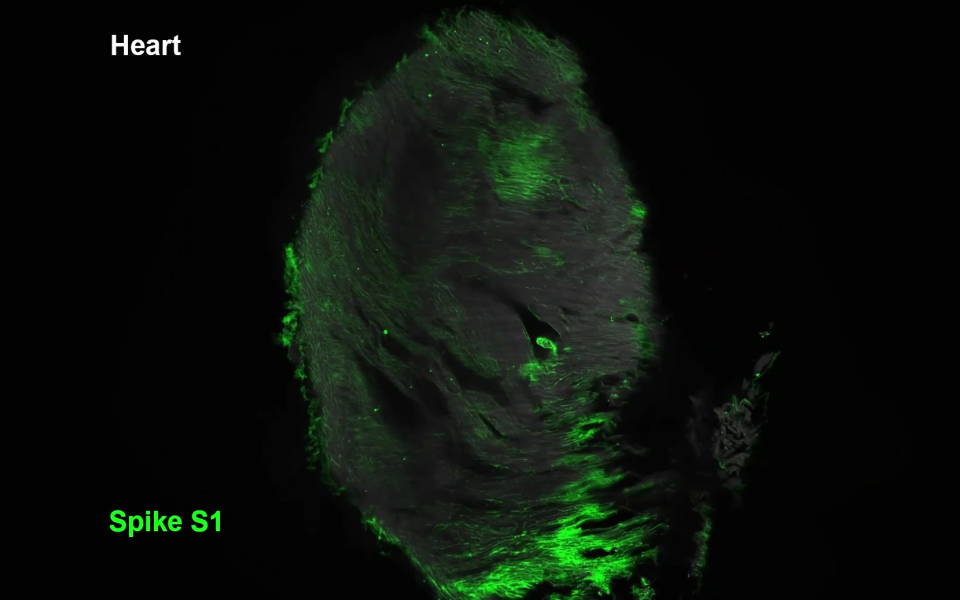S1 fehérjék egy egér agyának prefrontális kérgében S1 fehérje intravénás beadása után