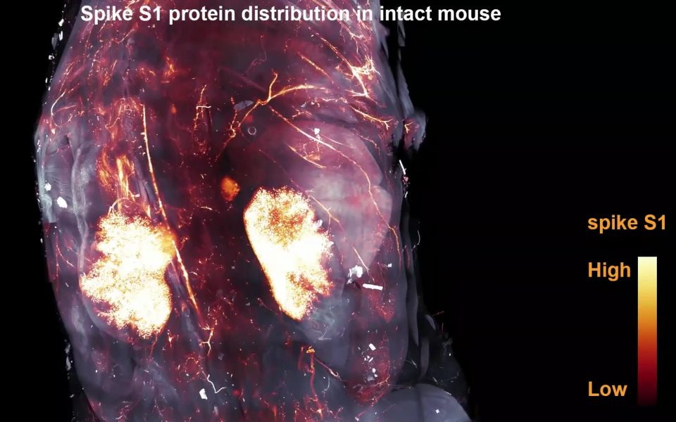 S1 fehérjék egy egér agyának prefrontális kérgében S1 fehérje intravénás beadása után